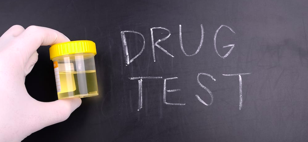 Cos’è e quando si effettua il test antidroga sul lavoro