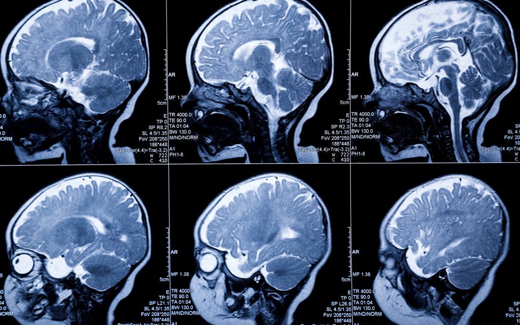Che effetti ha il THC sull’organismo umano